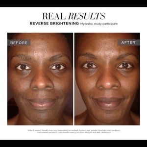 Rodan + Fields Skincare: Reverse Regimen